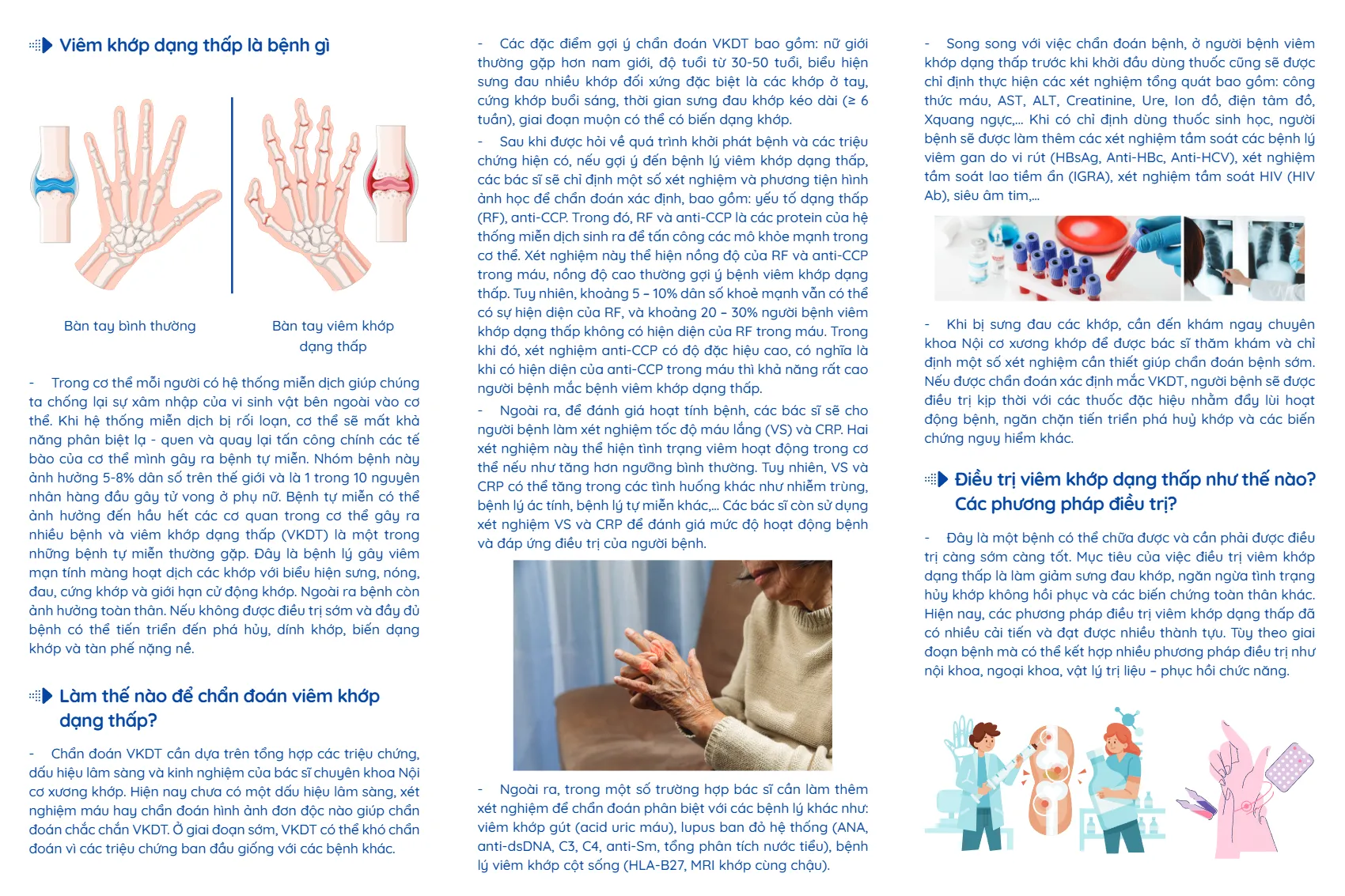 to roi nhung dieu can viet ve benh viem khop dang thap_2.webp